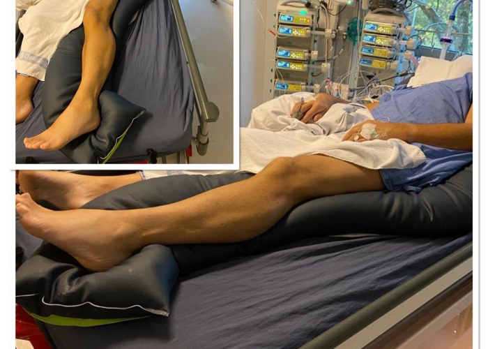 Supportkussens op de Intensive Care